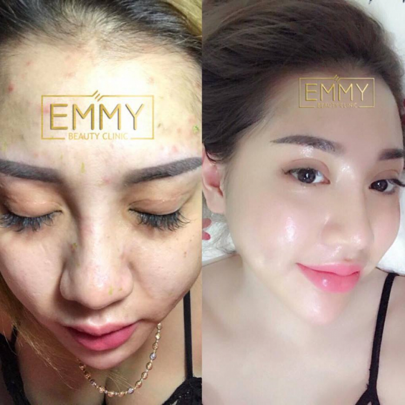Emmy Beauty Clinnic